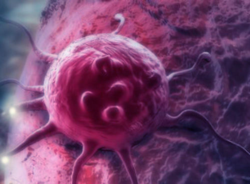 LypoC Cancer Cell