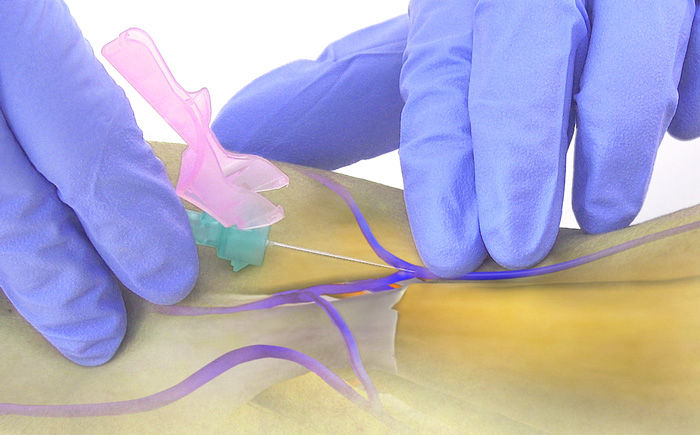 LypoC IV Injection